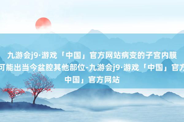 九游会j9·游戏「中国」官方网站病变的子宫内膜组织可能出当今盆腔其他部位-九游会j9·游戏「中国」官方网站